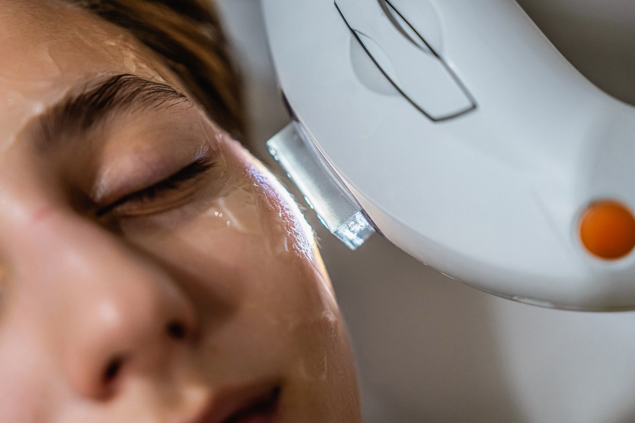 Phototherapy, photorejuvenation, IPL in a beauty salon. Care for a woman's face.